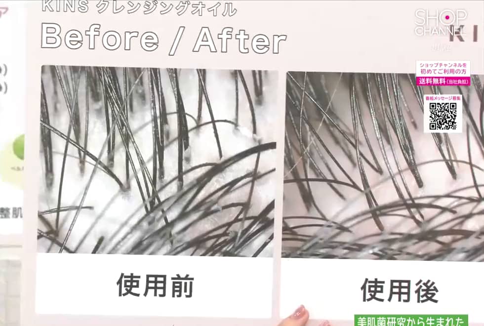 KINS 美肌菌発想で 毛穴の汚れすっきり 透明肌へ導く 潤い
