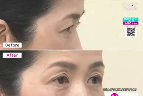 モアフロウ 特殊な人工皮膜を形成し 明るく朗らかな 二重の目元を演出